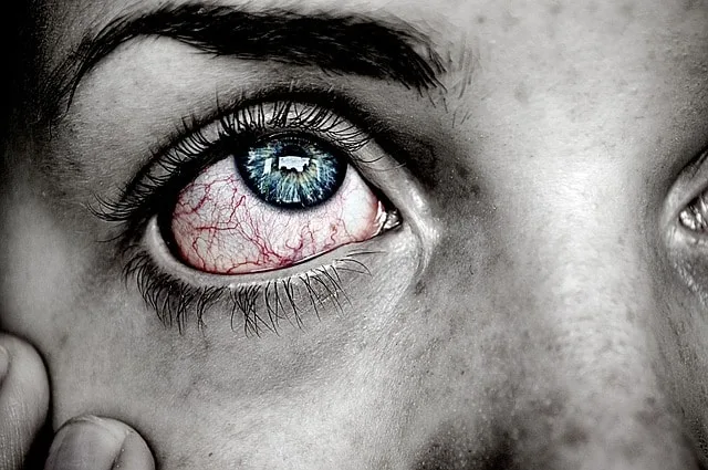 A close-up of a tearful eye.